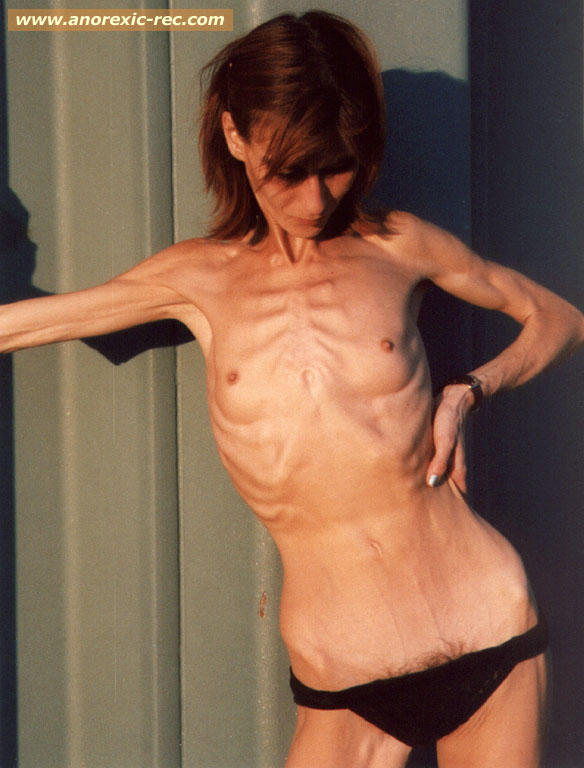 BONE THINSPIRATION picture