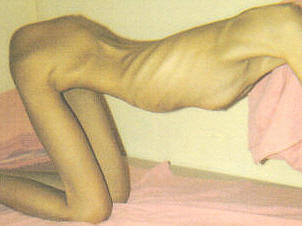 PROANA THINSPIRATION picture